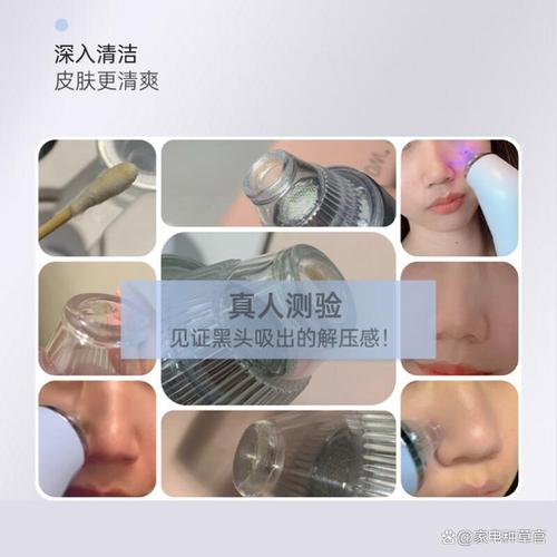 吸黑頭儀哪個(gè)品牌好用?2026年推薦的10款型號(hào):性價(jià)比高效果好!